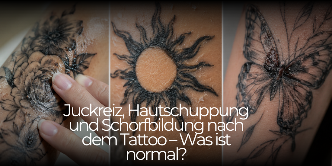Peeling, Itching and Scabbing After a Tattoo – What Do They Mean and How Should You Care for Your Skin?